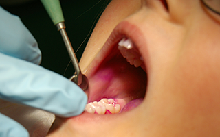 Insel Borkum Information